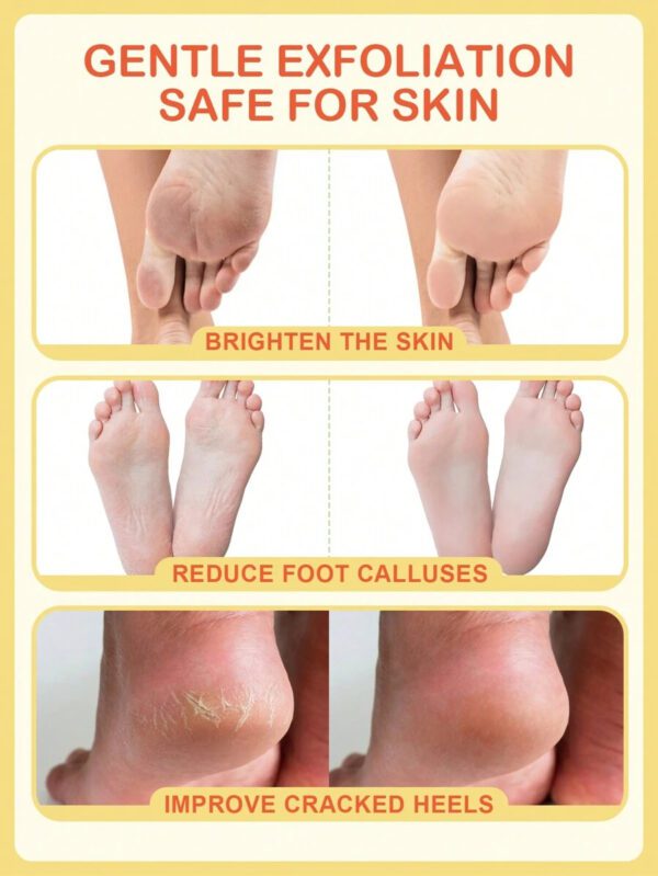 SlowSunday Peach Exfoliating Foot Peel Mask Repair Heels & Removes Dry Dead Skin- Peeling for Cracked Foot – Image 3