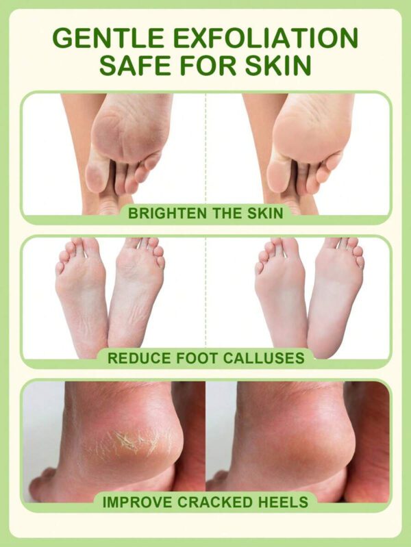 SlowSunday Peach Exfoliating Foot Peel Mask Repair Heels & Removes Dry Dead Skin- Peeling for Cracked Foot – Image 14