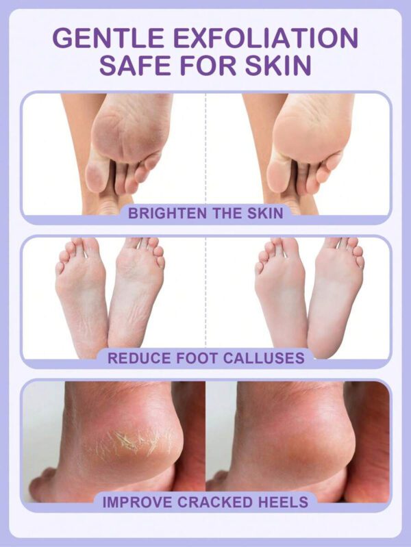 SlowSunday Peach Exfoliating Foot Peel Mask Repair Heels & Removes Dry Dead Skin- Peeling for Cracked Foot – Image 31