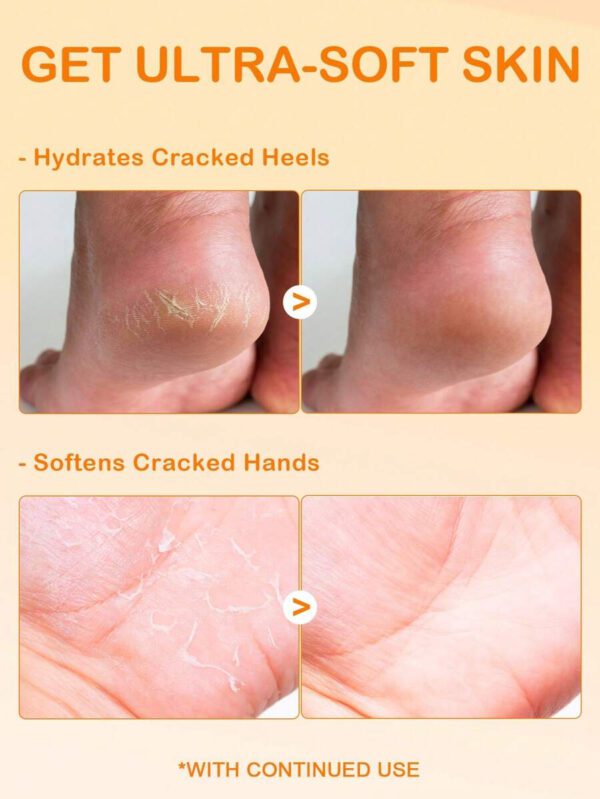 SlowSunday Salicylic Acid Moisturizing Foot Stick – Image 18