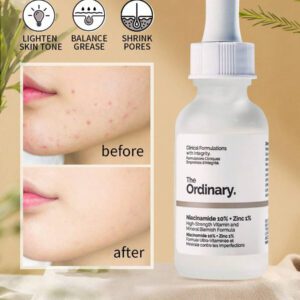 The Ordinary Traitement facial Niacinamide 10% + Zinc 1% 30ml